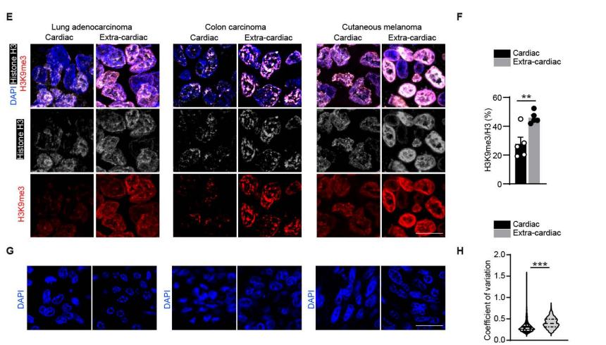 Fig.3E-H：三类癌症配对病灶的 H3K9me3/H3 与 DAPI compaction proxy。