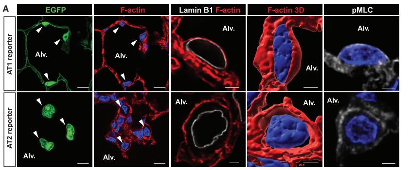 Fig.1A：AT1 与 AT2 的 F-actin、lamin B1 和 pMLC 结构对照；保留细胞类型、核周结构和 scale bars。