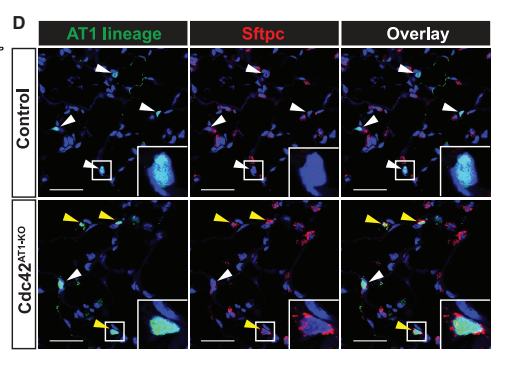 Fig.2D：同一 AT1 lineage label 在 control 与 Cdc42AT1-KO 中的 Sftpc acquisition；包含 key insets 与箭头标注。