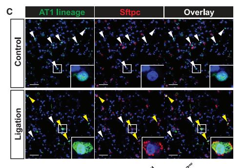Fig.7C：同鼠 control 与 ligated lung 的 AT1 lineage/Sftpc images；突出时间点、黄色 AT2rep arrows 和 insets。